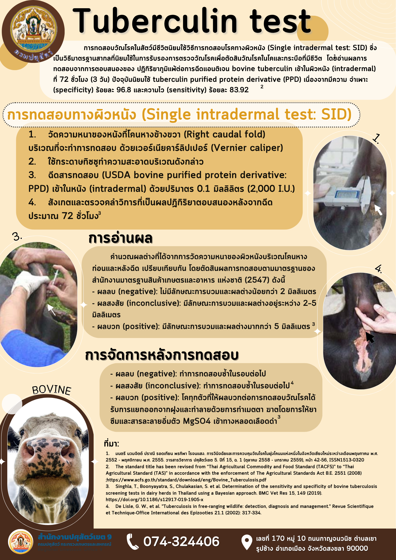 Tuberculin test
